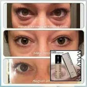 Mary Kay TimeWise Anti-Aging Eye Cream for Youthful Skin