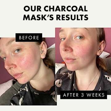 DETOXIFYING Charcoal Blackhead Peel Off Face Mask - Black Head Remover Mask for Face with Kaolin+Bentonite Clay, Organic Blackhead Removal Face Masks, Skincare Face Care Kit Pore Mask, Blackhead Extra