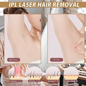 Effortless At-Home Laser Hair Removal Device for All