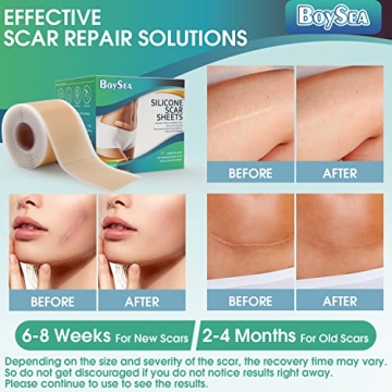 Professional Silicone Scar Sheets for Effective Scar Healing