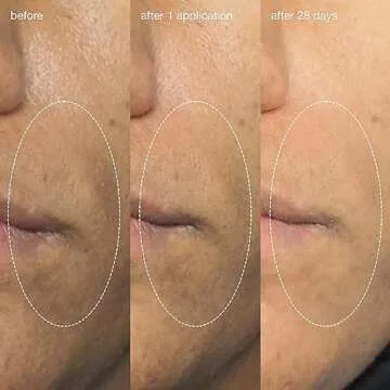 Dermalogica Liquid Peelfoliant with Glycolic Acid, Face Exfoliator Peel with AHA BHA PHA, Smooths Fine Lines and Wrinkles, Unclogs Pores, and Improve Skin Tone - 2 fl oz