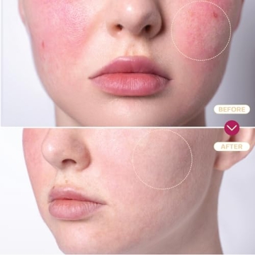 BASE LABORATORIES Hypochlorous Acid Spray for Skin Repair