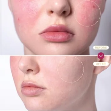 BASE LABORATORIES Hypochlorous Acid Spray for Skin Repair