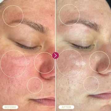 BASE LABORATORIES Hypochlorous Acid Spray for Skin Repair