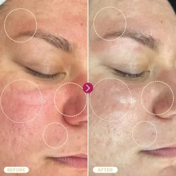 BASE LABORATORIES Hypochlorous Acid Spray for Skin Repair