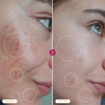 BASE LABORATORIES Hypochlorous Acid Spray for Skin Repair