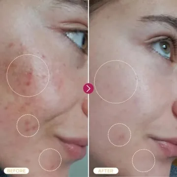 BASE LABORATORIES Hypochlorous Acid Spray for Skin Repair