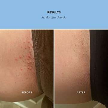 Bushbalm Exfoliating Scrub for Smooth Skin and ingrown Hairs