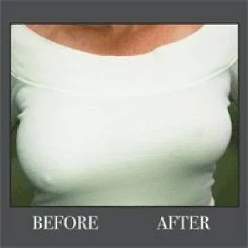 Bring It Up Instant Breast Lifts - Ideal for DD Cup Sizes Available
