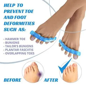 Toe Separators for Bunion & Hammer Toe Relief - Blue