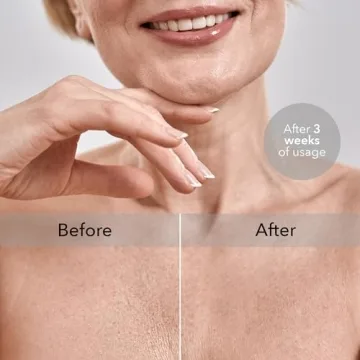 Intimia Breast Pillow for Chest Wrinkle Prevention