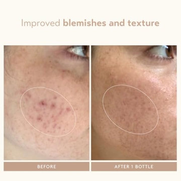 Revolutionary Retinol Serum for Youthful Skin