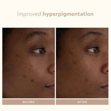 Revolutionary Retinol Serum for Youthful Skin