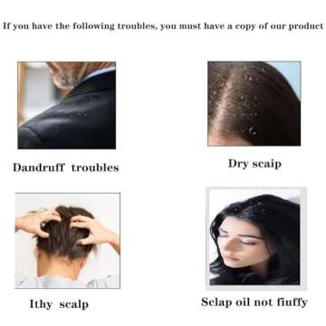 KFASANOMDZ Hair Comb, Dandruff Removal Comb Plastic, All Hair Types, Manual, for People with Dandruff Problems