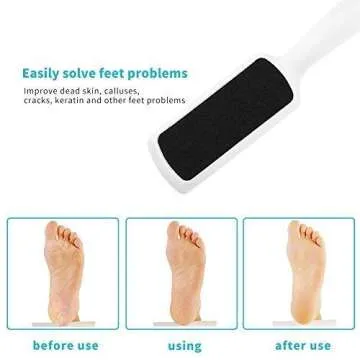 Foot File Set - 3 Pack for Professional Pedicure at Home