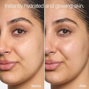 Clinique Moisture Surge Hydrating Face Moisturizer 72H