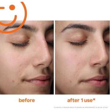 Kate Somerville ExfoliKate Cleanser – Daily Exfoliating Foaming Face Wash – Clinically Formulated Glycolic Acid and Lactic Acid Gentle Facial Scrub, 1.7 Fl Oz