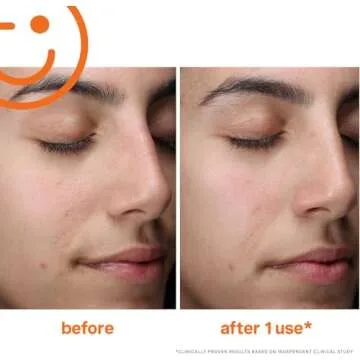 Kate Somerville ExfoliKate Cleanser – Daily Exfoliating Foaming Face Wash – Clinically Formulated Glycolic Acid and Lactic Acid Gentle Facial Scrub, 1.7 Fl Oz