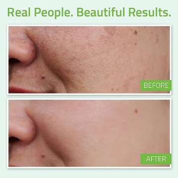 YEOUTH Hyaluronic Acid Serum - Hydrating Anti-Aging Formula