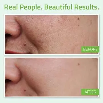 YEOUTH Hyaluronic Acid Serum - Hydrating Anti-Aging Formula