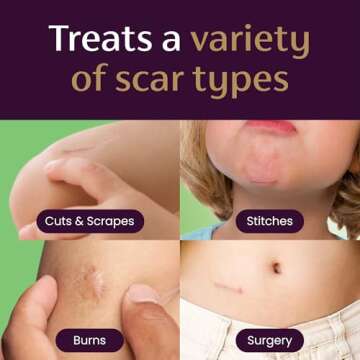 Mederma Scar Gel for Kids; Reduces the Appearance of Old and New Scars from Cuts, Burns, Surgery; Goes on Purple and Rubs in Clear; Grape Scented; Ages 2+, 0.70 Oz