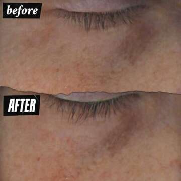 Kiehl's Powerful-Strength 10% Vitamin C Eye Serum, Line-Reducing & Dark Circle Diminishing Eye Cream, Smooths & Hydrates Undereye, for Puffiness & Lines, with Hyaluronic Acid & Tri-Peptide - 0.5 fl oz