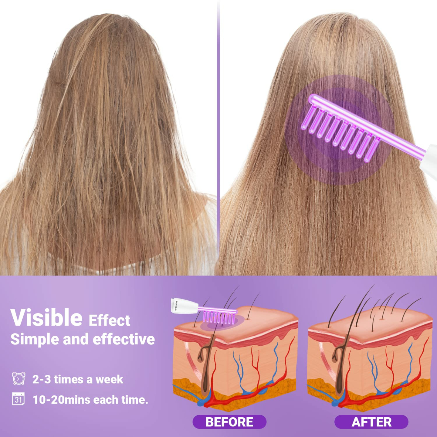 UUPAS High Frequency Facial Machine for Home Use