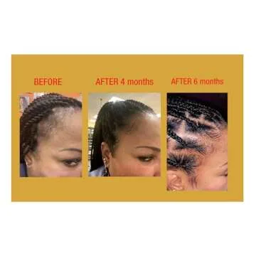 GOOD2GRO Hair Resuscitator with SureGro - 4oz | Repairs, Restores & Regrows Hair | Root-Activating with Tingling Sensation for Healthy Follicle Growth | Vegan & Cruelty-Free