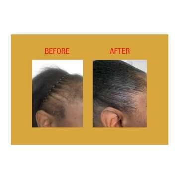 GOOD2GRO Hair Resuscitator with SureGro - 4oz | Repairs, Restores & Regrows Hair | Root-Activating with Tingling Sensation for Healthy Follicle Growth | Vegan & Cruelty-Free