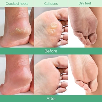 PLANTIFIQUE Foot Peeling Mask for Soft Feet