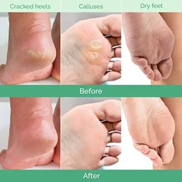 PLANTIFIQUE Foot Peeling Mask for Soft Feet