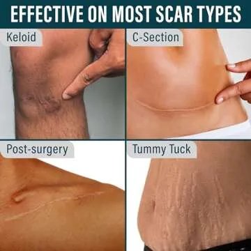 NUVADERMIS Clear Silicone Scar Tape for Surgical Scars - 120" x 1.5" Roll - Extra Long Scar Sheets for C-Section, Tummy Tuck, Keloid, and Surgical Scars - Reusable Medical Grade Silicone Scar Tape