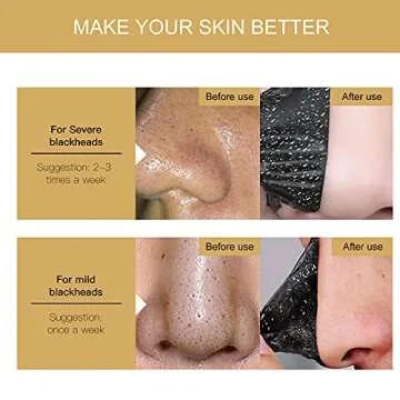 Vanecl Blackhead Remover Mask for All Skin Types