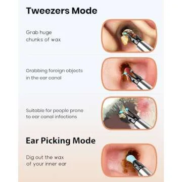 BEBIRD Note 5 Ear Cleaner with HD Camera and Tweezers