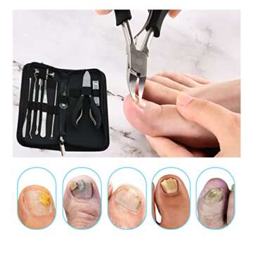 Bcabo 10Pcs Ingrown Toenail Tools Kit for Perfect Nails