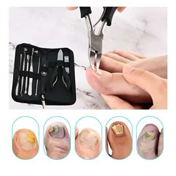 Bcabo 10Pcs Ingrown Toenail Tools Kit for Perfect Nails