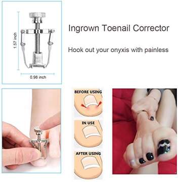 Bcabo 10Pcs Ingrown Toenail Tools Kit for Perfect Nails