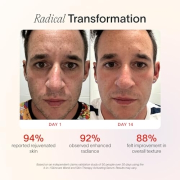 Solawave 4-in-1 Radiant Renewal Facial Wand