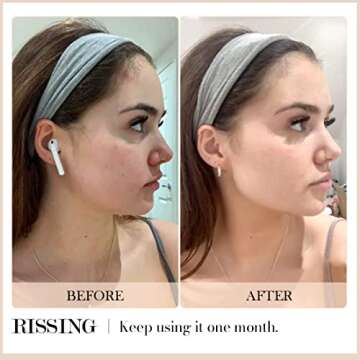 RISSING 4-in-1 Gua Sha Facial Tools: FSA/HSA Eligible, Lymphatic Drainage Massager Facial Roller for Wrinkles and Lifting, Stainless Steel Gua Sha Tool for Face (Portable Box Edition)