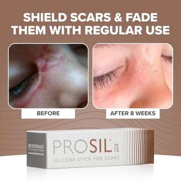 ProSil Silicone Scar Gel Stick with SPF 15 - Mess-Free Application
