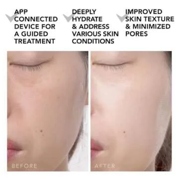 FOREO UFO 2 Supercharged Face Mask | Full LED Spectrum & Red Light Therapy for Face | Warming | | Face Moisturizer | Dark Spot & Acne Scar Treatment for Face | Anti Aging | Nourishing| Black