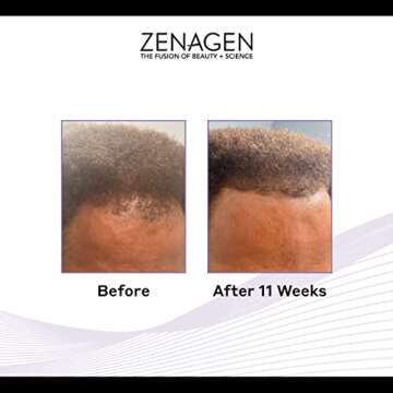 Zenagen Revolve Shampoo For Men | Supports Scalp Health & Appearance of Fuller, Healthier-Looking Ha...
