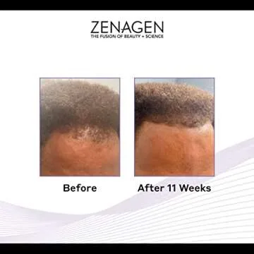 Zenagen Revolve Shampoo For Men | Supports Scalp Health & Appearance of Fuller, Healthier-Looking Ha...