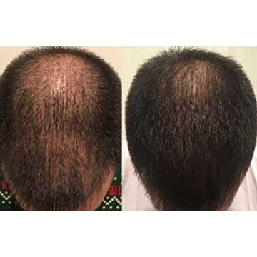 Zenagen Revolve Shampoo for Men - Fuller Healthier Hair