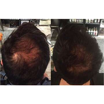 Zenagen Revolve Shampoo for Men - Fuller Healthier Hair