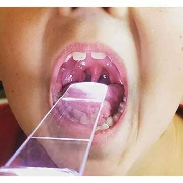 Throat Scope Medical Pack - Reliable Examination Tool