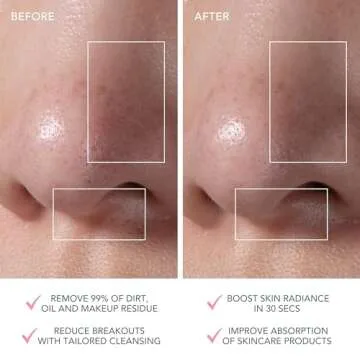 FOREO LUNA mini 3 Ultra-hygienic Facial Cleansing Brush - All Skin Types - Face Massager for Clean & Healthy Face Care - Extra Absorption of Facial Skin Care Products - Waterproof - Pearl Pink