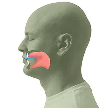 Nose Breathe Trainer for Better Sleep and Breathing