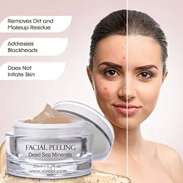 Vivo Per Lei Facial Peeling Gel Gentle Exfoliator