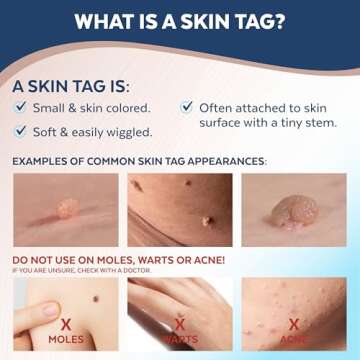 FDA-Cleared Skin Tag Removal Device – Claritag